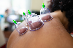 Piles Cupping Therapy