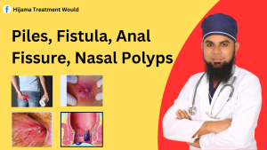 Piles, Fistula, Anal Fissure, Nasal Polyps স্থায়ী চিকিৎসা ঢাকা