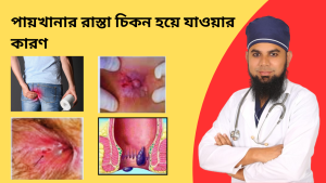 মলদ্বারে সমস্যা কেন হয় এবং পায়খানার রাস্তা চিকন হয়ে যাওয়ার কারণ