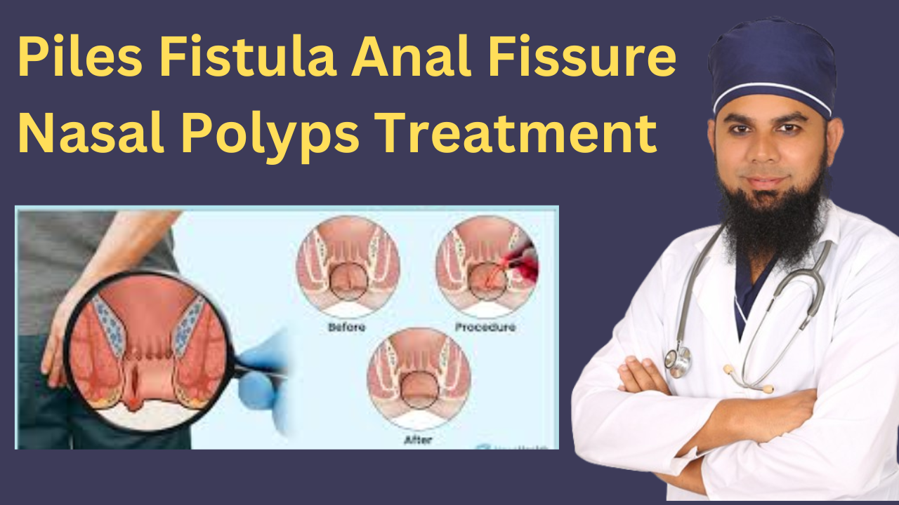 Piles Fistula Anal Fissure Nasal Polyps Treatment