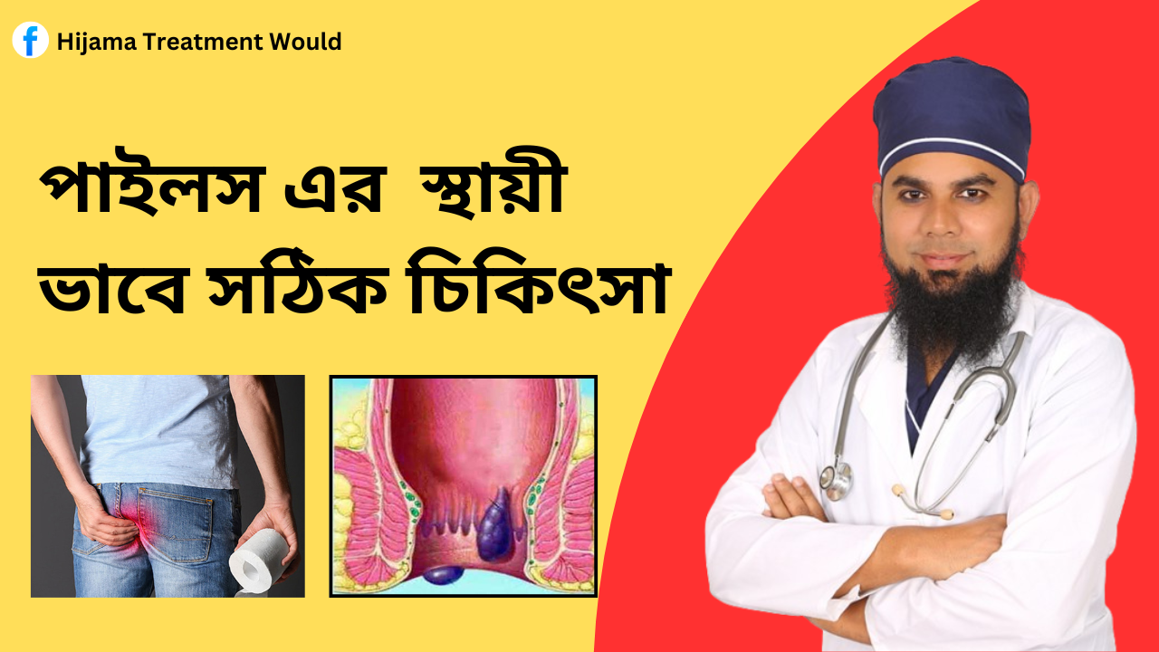 Piles centre Dhaka Uttara | অপারেশন ছাড়া পাইলস এর চিকিৎসা
