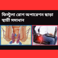 ফিস্টুলা রোগের লক্ষণ কি এবং অপারেশন ছাড়া স্থায়ী সমাধান