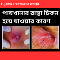 মলদ্বারে এবং পায়খানা রাস্তার সব সমস্যার স্থায়ী চিকিৎসা