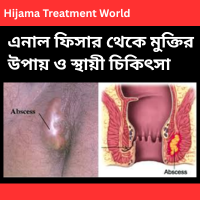এনাল ফিসার থেকে মুক্তির উপায় ও স্থায়ী চিকিৎসা