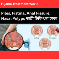 Best Piles Fistula Treatment