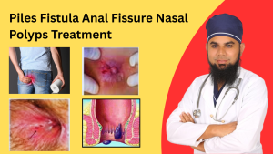 Piles Treatment | Fistula Anal Fissure Nasal Polyps Treatment
