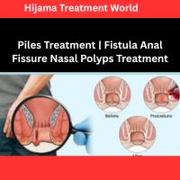 Piles Treatment | Fistula Anal Fissure Nasal Polyps Treatment