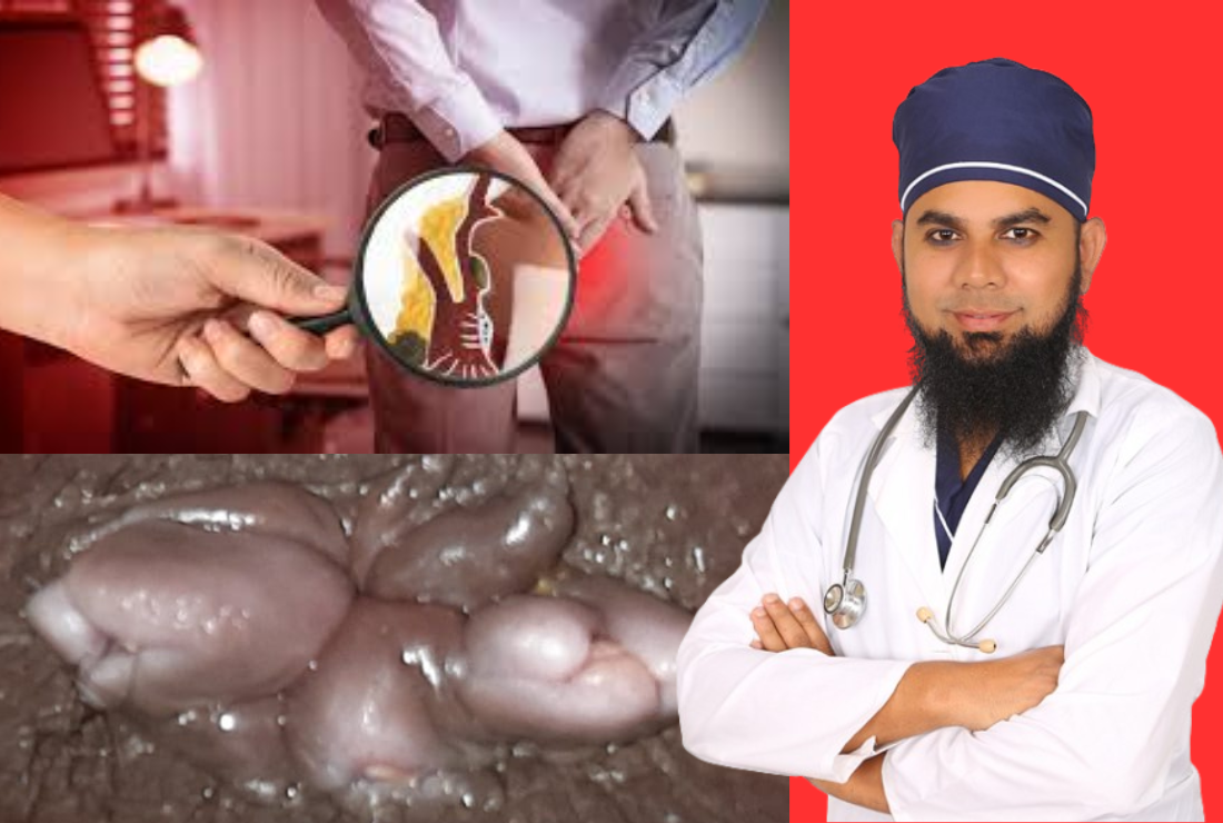 Anal Fissure Symptoms & Treatment